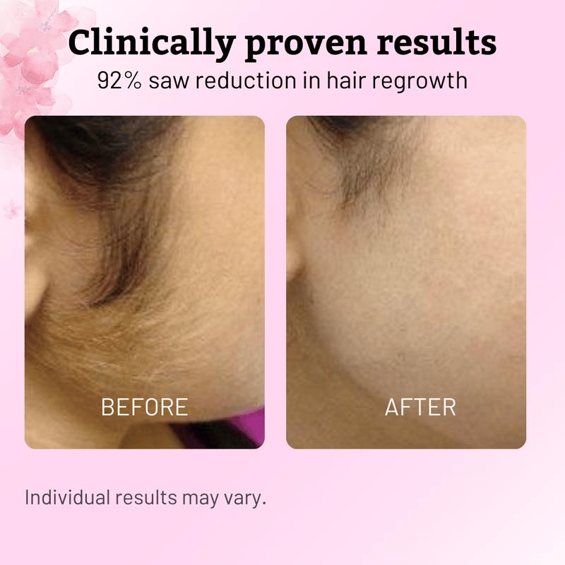 ✨  Cyperus Rotundus Oil for Natural Permanent Hair Reduction