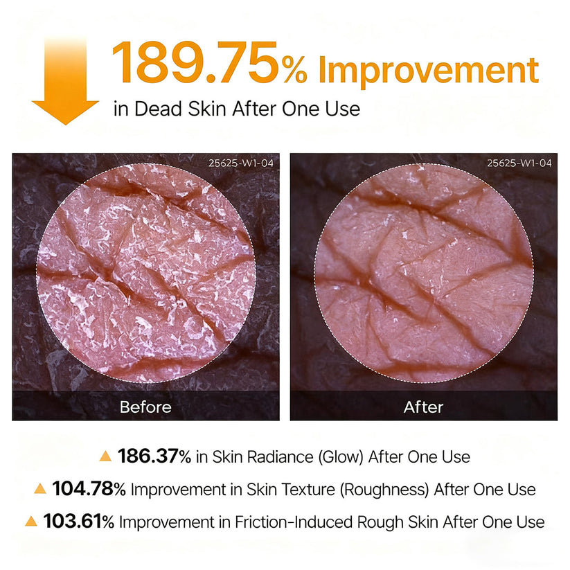 Trovehand Peel Shot - Kojic + Turmeric Body Peel Spray