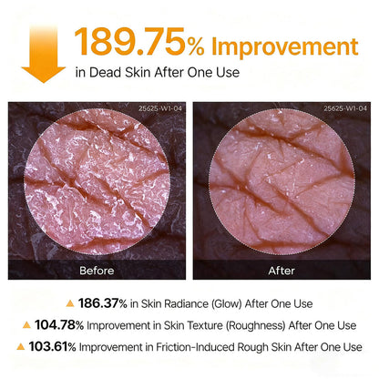 Trovehand Peel Shot - Kojic + Turmeric Body Peel Spray