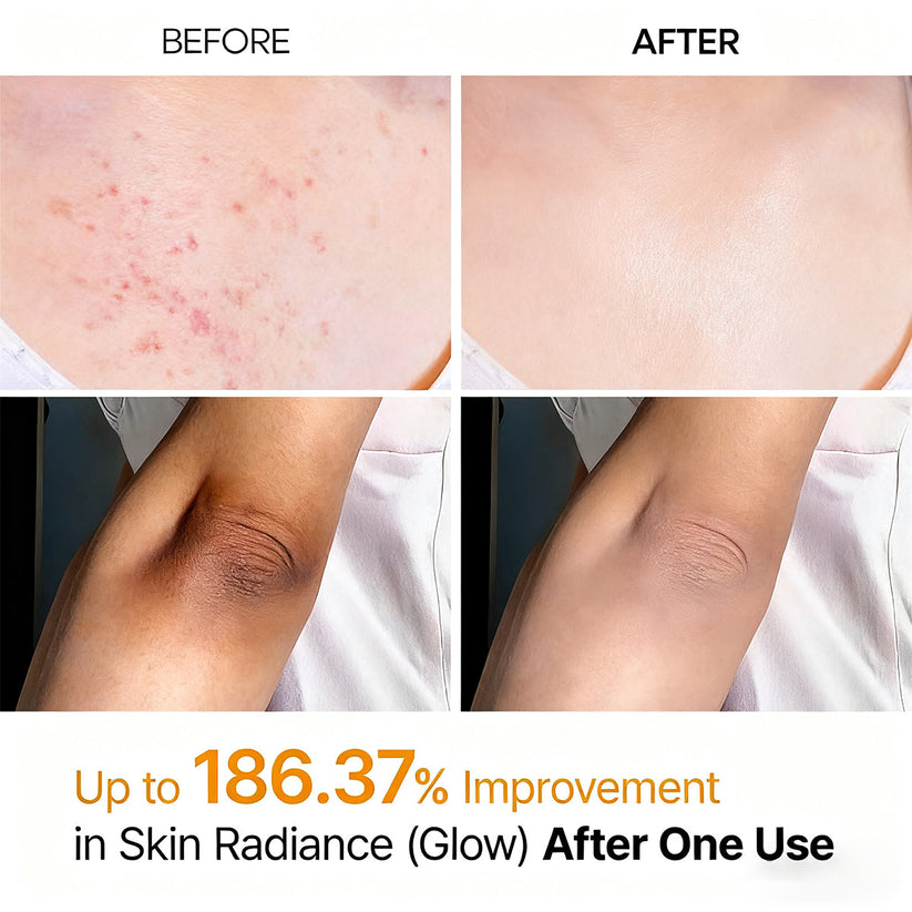 Trovehand Peel Shot - Kojic + Turmeric Body Peel Spray